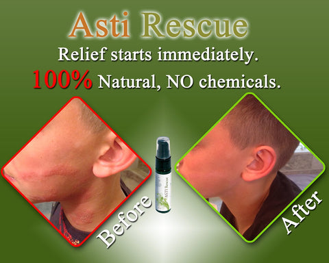 Rescue - Best Natural Remedy for Rashes